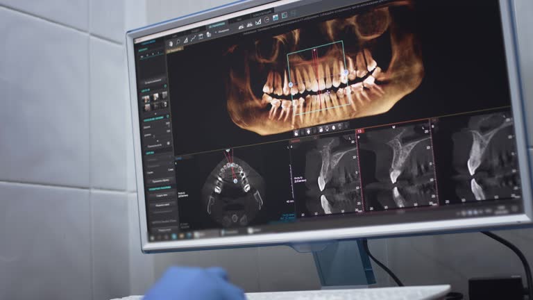 Full Mouth Reconstruction in Silver Hill, MD